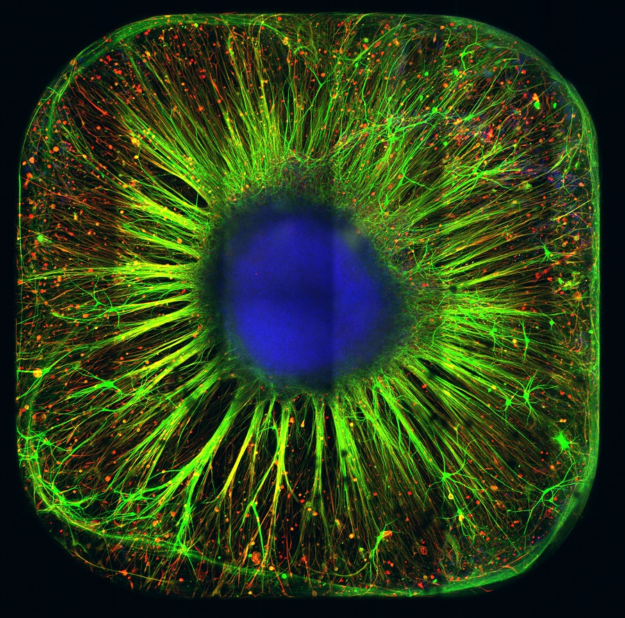 Organoid wyhodowany w laboratorium Łukasiewicz - PORT